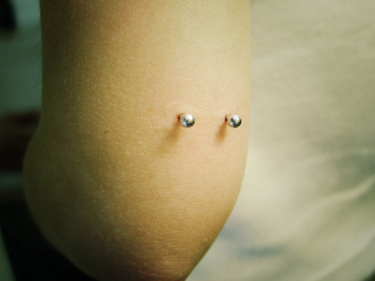 000 microdermals