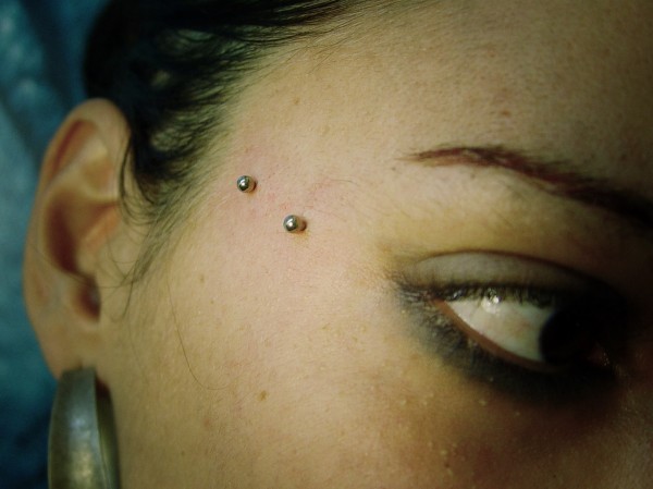 011 microdermals