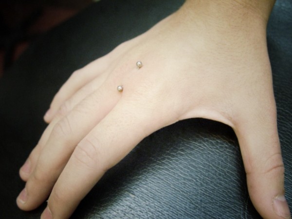 013 microdermals