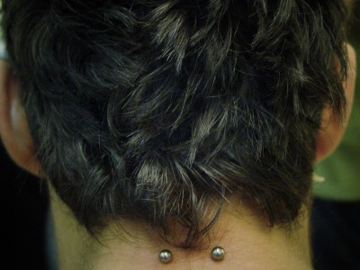014 microdermals