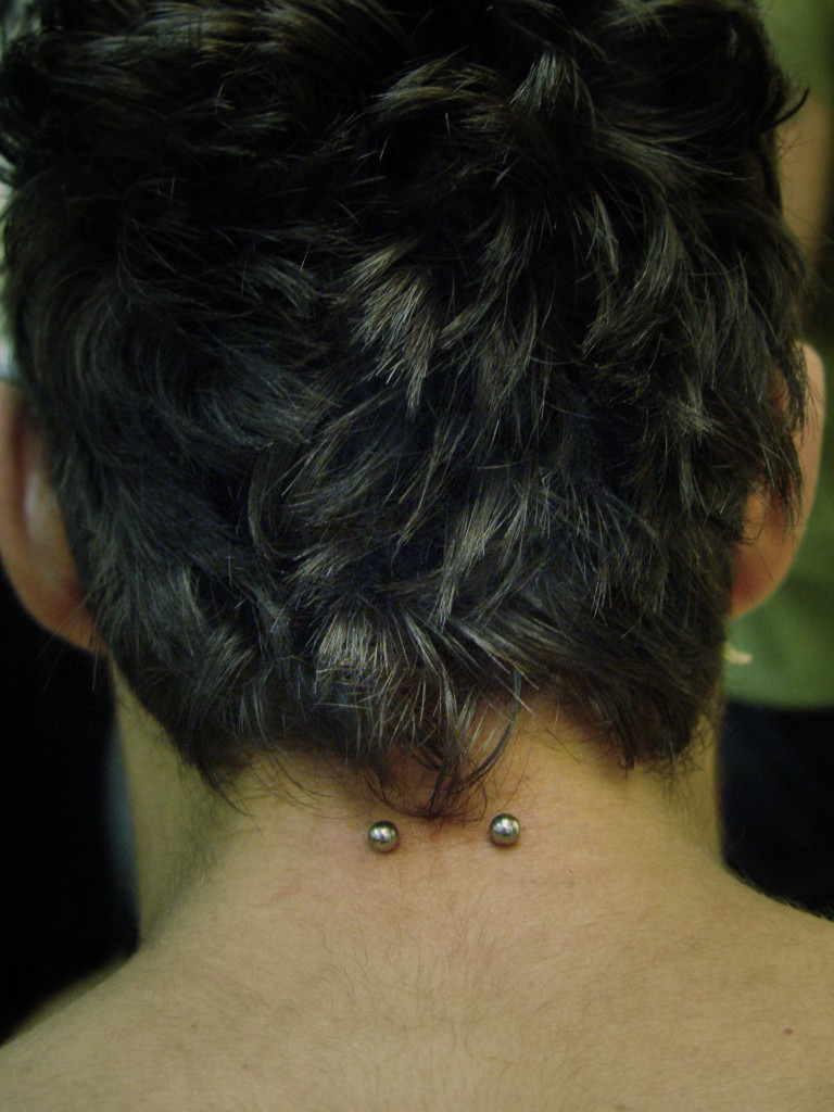 014 microdermals