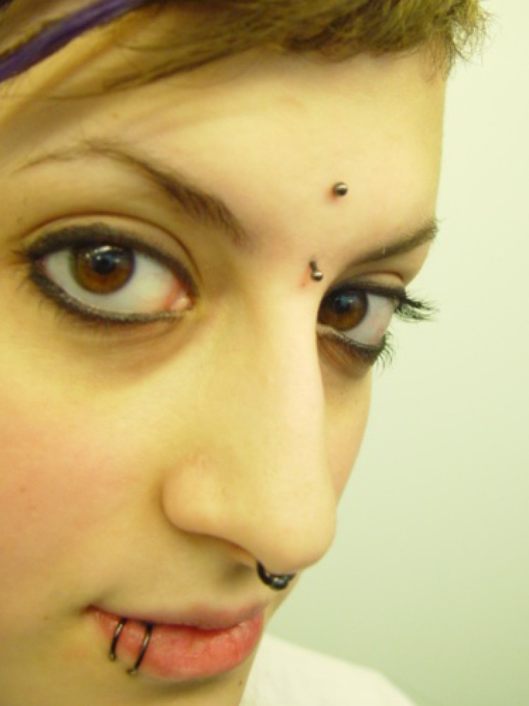 017 microdermals