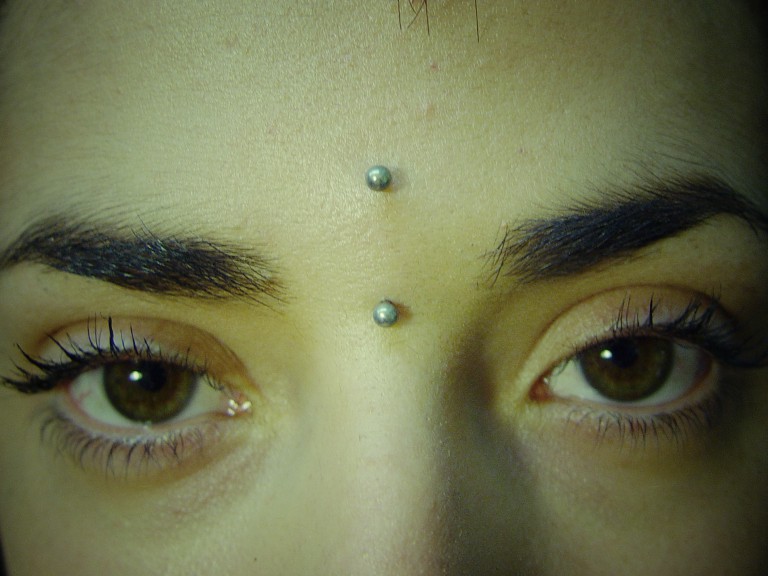 019 microdermals