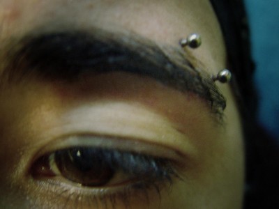 021 microdermals