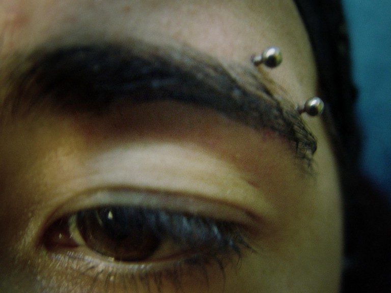 021 microdermals