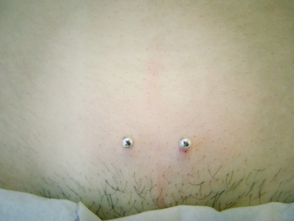 022 microdermals