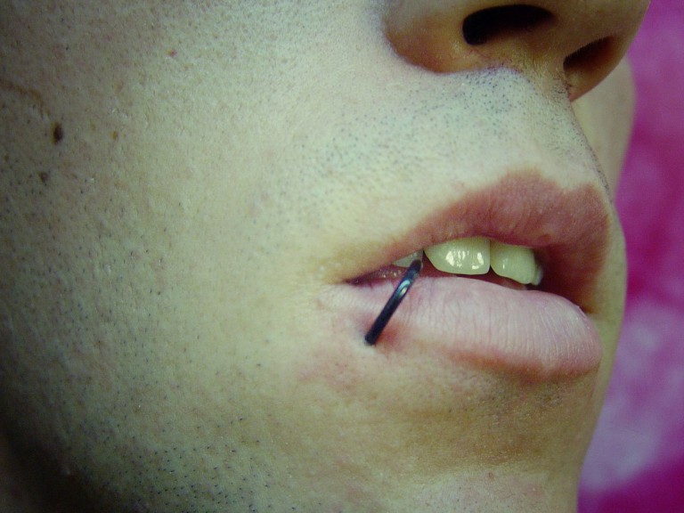 003 facial boca