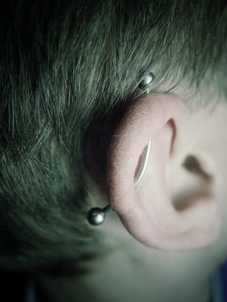 001 oreja bicartilago