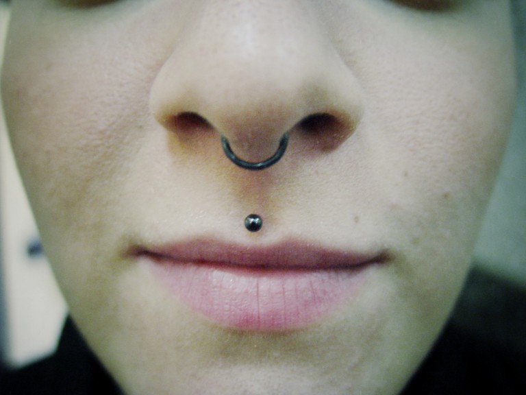 003 facial index