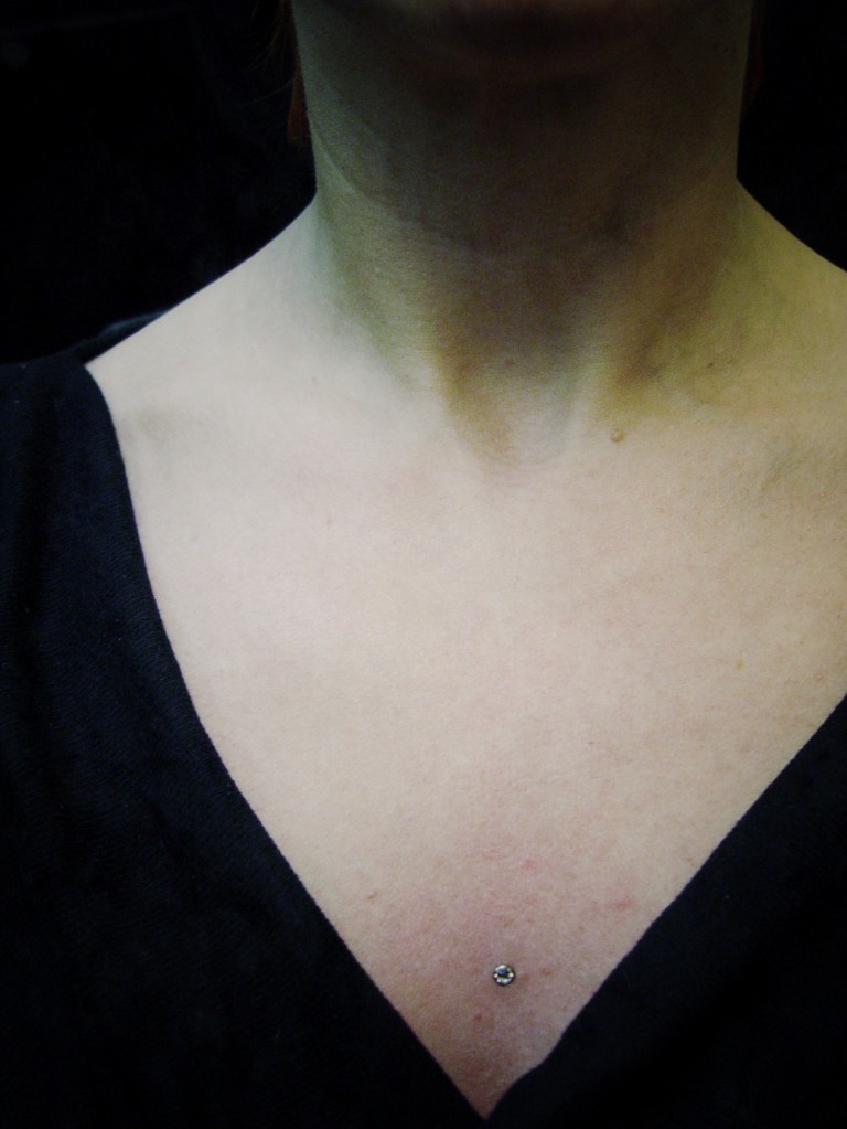 BPmicrodermals005