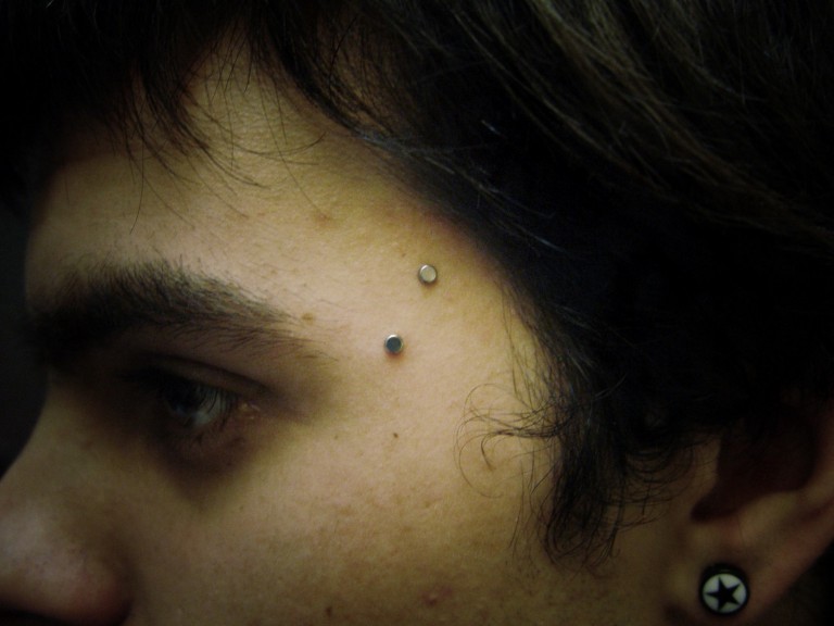 BPsienmicrodermals003